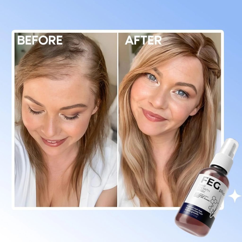 FEGPlus Minoxidil Beard & Hair Growth Serum Your Store