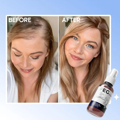 FEGPlus Minoxidil Beard & Hair Growth Serum Your Store