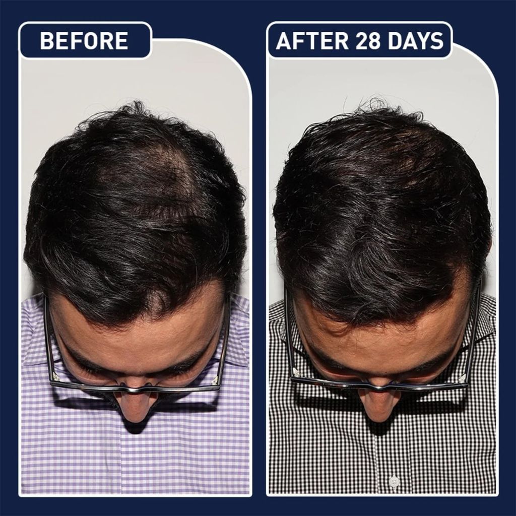 FEGPlus Minoxidil Beard & Hair Growth Serum Your Store