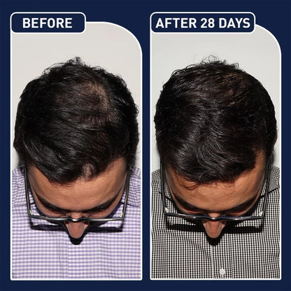 FEGPlus Minoxidil Beard & Hair Growth Serum Your Store