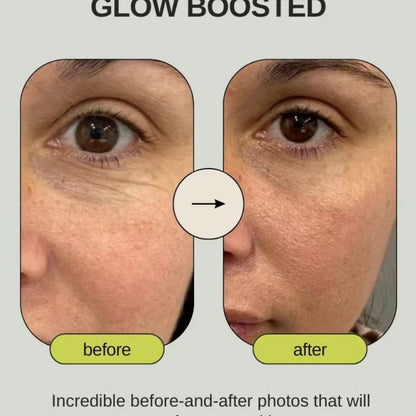 Retinal Shot Tightening Booster Your Store