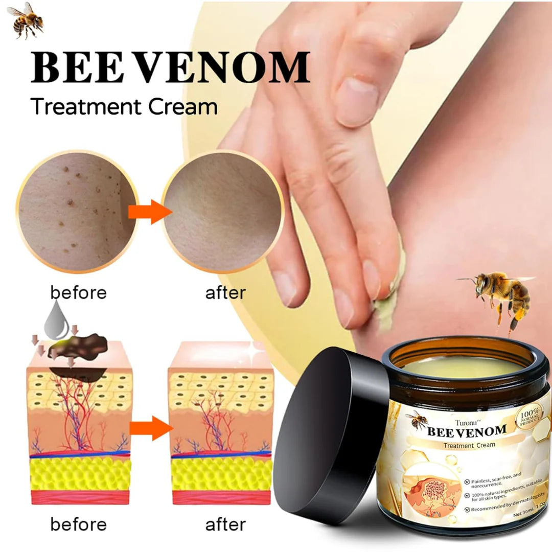 Bee Venom Skin Treatment Cream Your Store