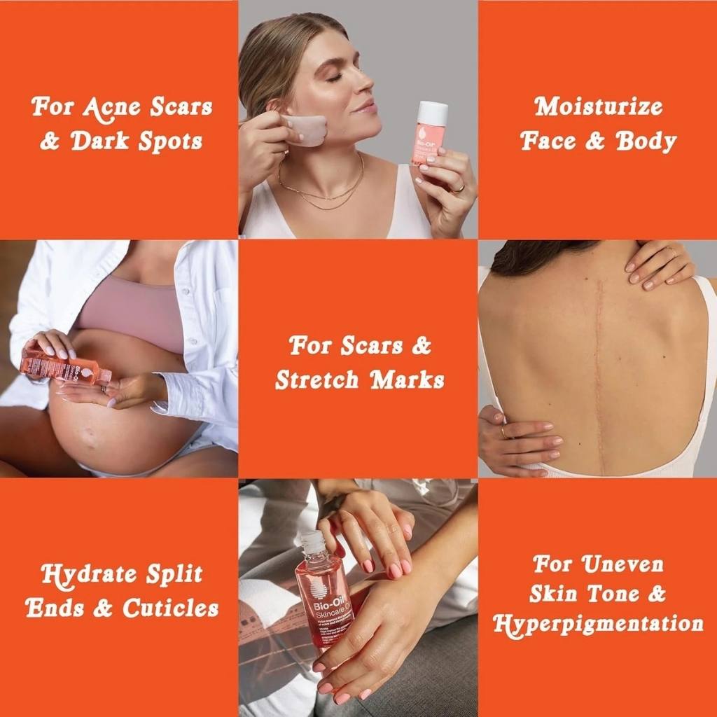 Bio-Oil  6.7 Ounce, Body Oil for Scars and Stretchmarks Your Store