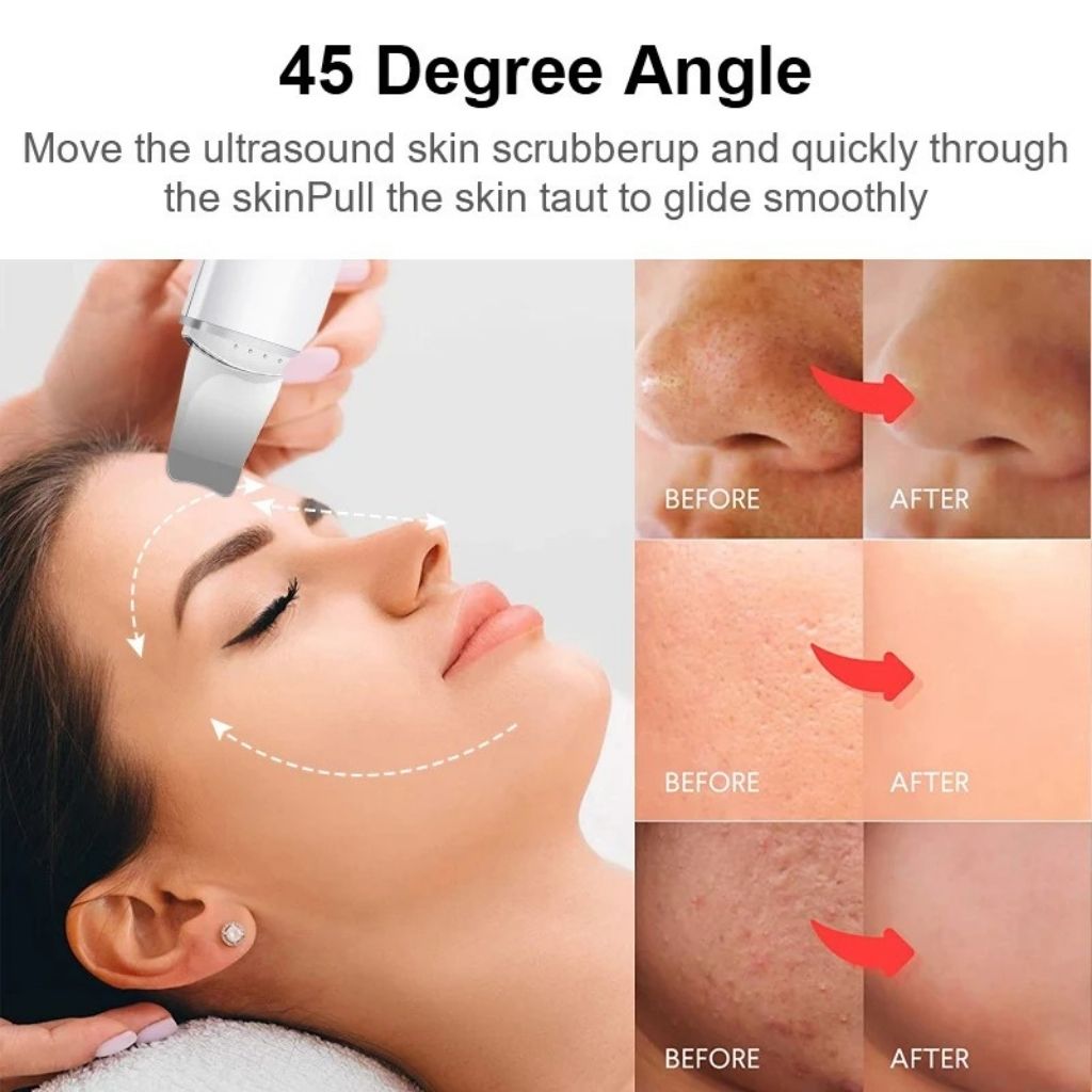 Face Blackhead Remover Your Store