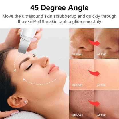 Face Blackhead Remover Your Store